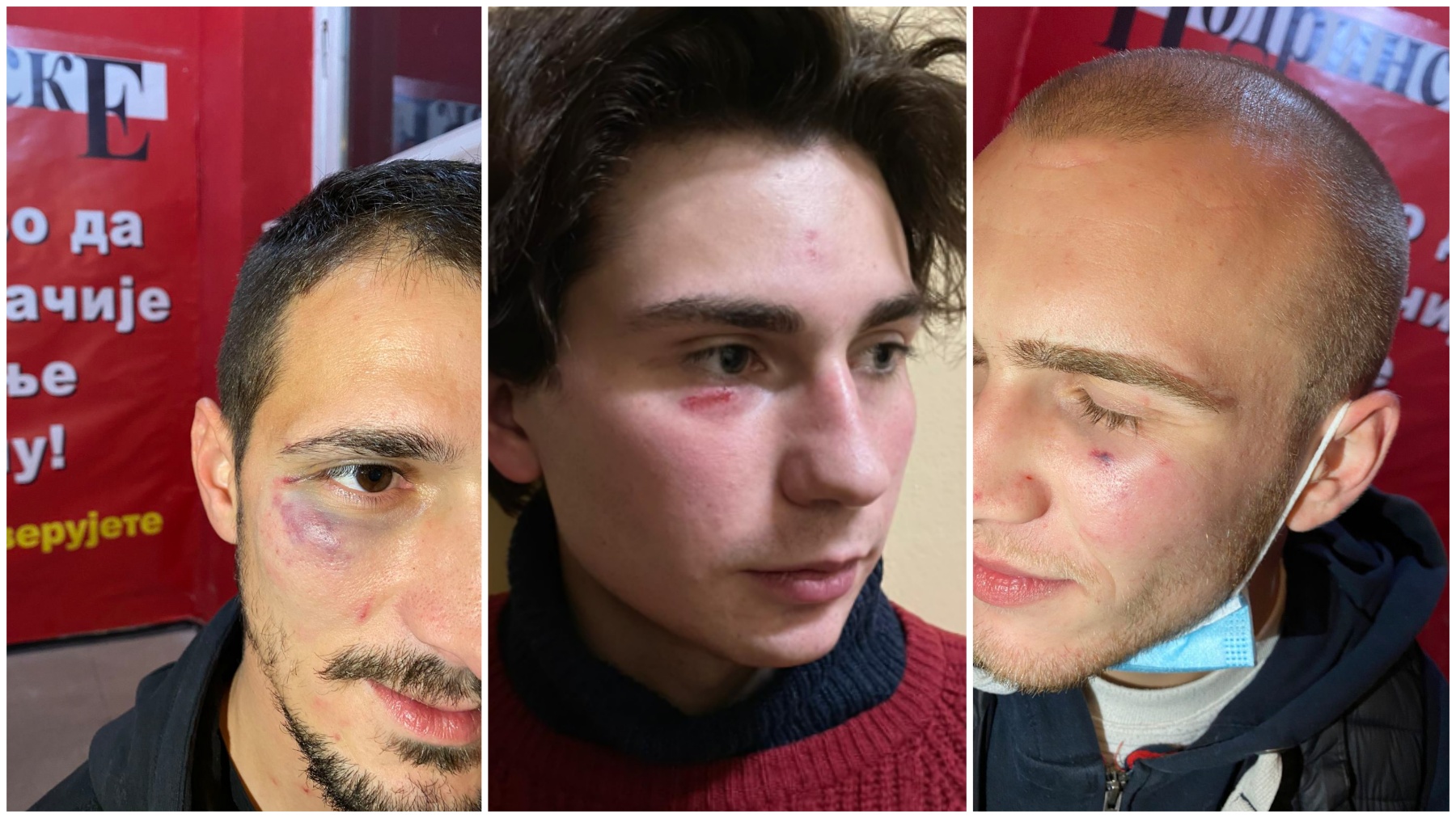 Pretučeni na skupu naprednjaka u Šapcu